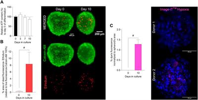 Development of three-dimensional primary human myospheres as culture model of skeletal muscle cells for metabolic studies